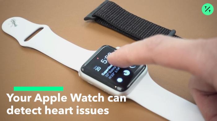 Apple watch will try to reduce false afib notifications