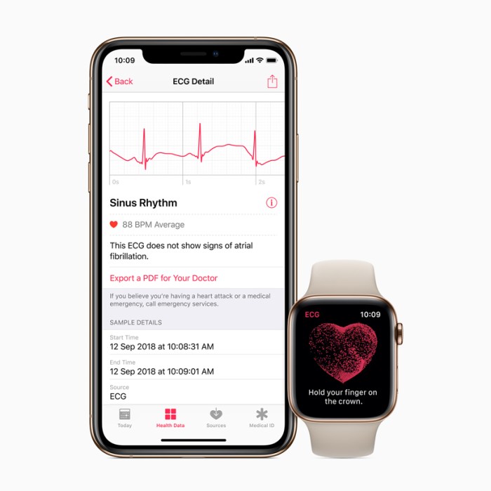 Apple watch will try to reduce false afib notifications