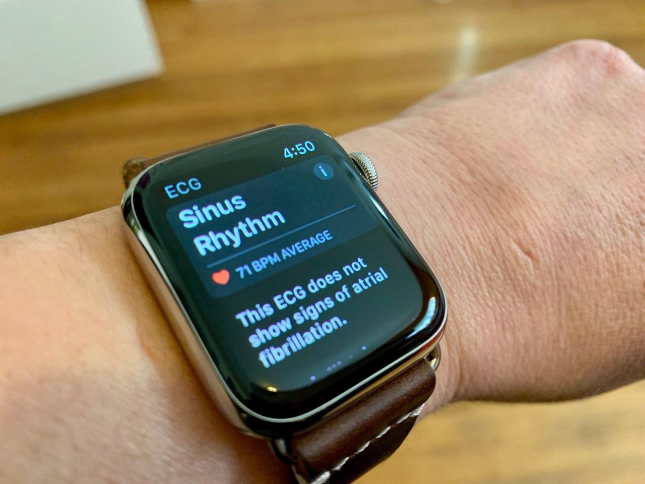 Apple watch ecg feature saves yet another life